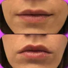 Unternehmen 8 Bild ALEX NAILS Maniküresalons am Wetzikon ZH