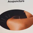 Immagine 2 azienda CHINATANG ACUPUNCTURE ET MÉDECINE CHINOISE Ärzte in Lausanne VD