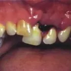Immagine 6 azienda DENTAL LABOR GRÜTTER - SPORTMUNDSCHUTZ Ärzte in Grenchen SO