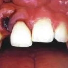 Immagine 7 azienda DENTAL LABOR GRÜTTER - SPORTMUNDSCHUTZ Ärzte in Grenchen SO
