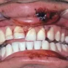 Immagine 5 azienda DENTAL LABOR GRÜTTER - SPORTMUNDSCHUTZ Ärzte in Grenchen SO