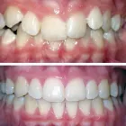 Immagine 12 azienda DENTALNEXT Ärzte in Pambio-Noranco TI