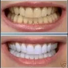 Immagine 5 azienda DENTALNEXT Ärzte in Pambio-Noranco TI