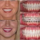 Immagine 6 azienda DENTALNEXT Ärzte in Pambio-Noranco TI