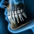 Entreprises 1 image DR JACQUES CHEYLUS - CHIRURGIE ET DENTISTERIE ESTHÉTIQUE À CAROUGE Ärzte dans Carouge GE