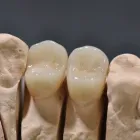 Unternehmen 4 Bild DR. MED. DENT. JÜRG SCHENK Ärzte am Bubendorf BL
