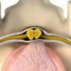 Immagine 4 azienda PHYSIOTHERAPIE HEINIGER UND PSYCHOLOGISCHE KÖRPERARBEIT Ärzte in Zurich ZH