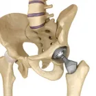 Immagine 9 azienda PHYSIOTHERAPIE HEINIGER UND PSYCHOLOGISCHE KÖRPERARBEIT Ärzte in Zurich ZH