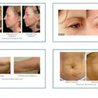 Immagine 3 azienda STUDIO DI MEDICINA ESTETICA DR. MED. MONIQUE WORTELBOER Ärzte in Lugano TI