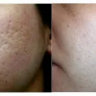 Immagine 1 azienda STUDIO DI MEDICINA ESTETICA DR. MED. MONIQUE WORTELBOER Ärzte in Lugano TI