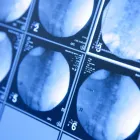 Immagine 5 azienda UROVIVA PRAXIS FÜR UROLOGIE HÖNGG Ärzte in Zürich ZH