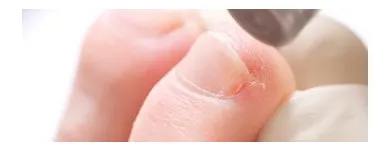 Entreprises 1 image PEDI-FUSS - FUSSPFLEGEPRAXIS & MEHR Maniküresalons dans Zürich ZH