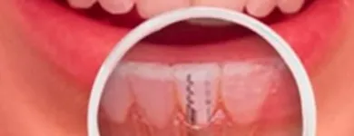 Immagine 6 azienda STUDIO DENTISTICO DR. COLER SA Ärzte in Lugano TI