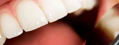 Immagine 5 azienda STUDIO DENTISTICO DR. COLER SA Ärzte in Lugano TI