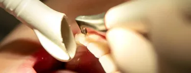 Immagine 8 azienda ZAHNARZTPRAXIS MUNDAUF AG Ärzte in St. Gallen SG